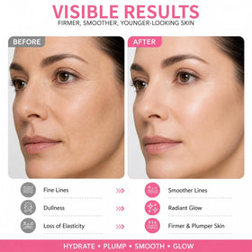 ruklob applying to neck and forehead for fuller-looking, hydrated skin