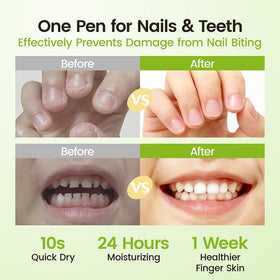 RUNBEN before and after nails showing repaired cuticles and stronger nails