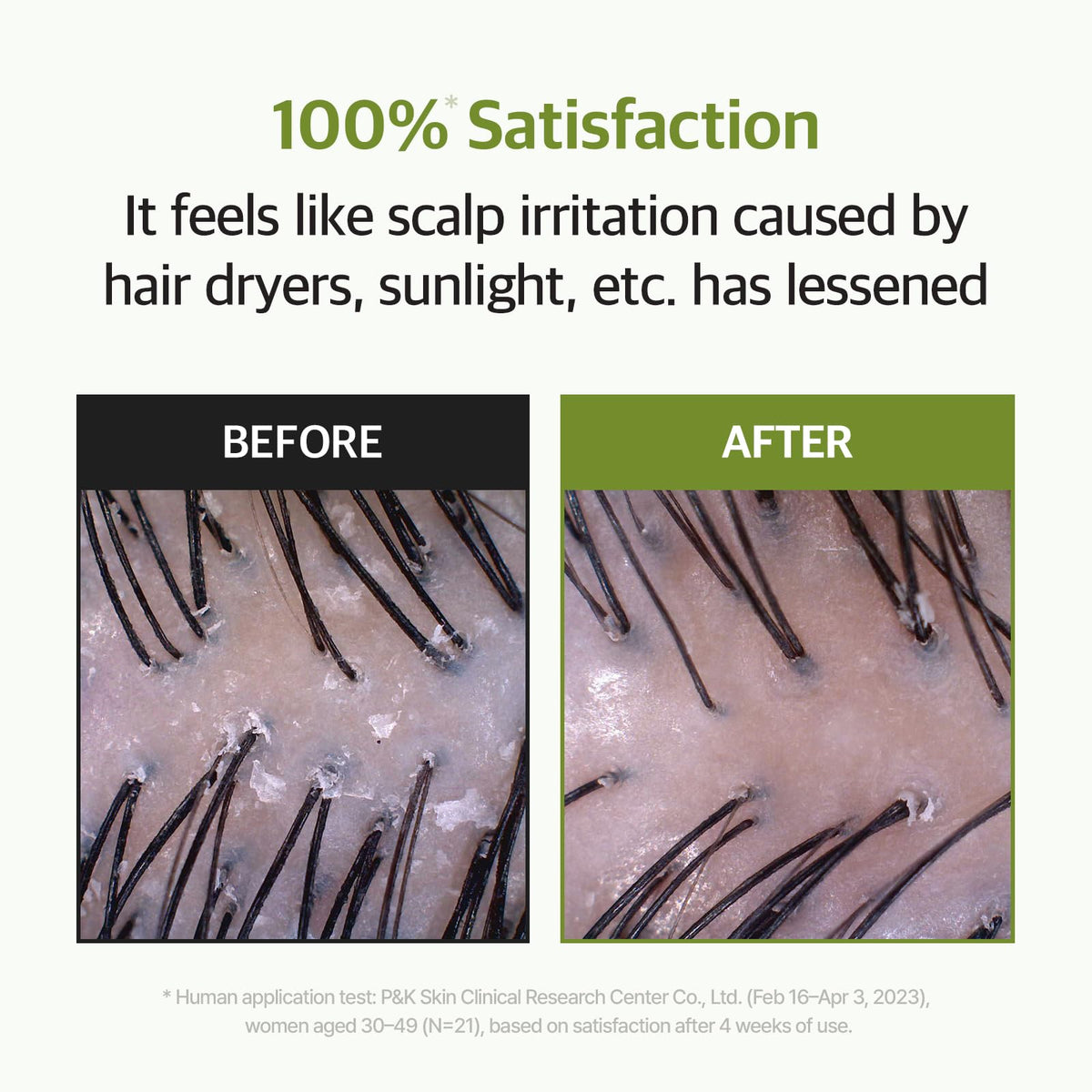 RYO precision applicator tip focusing on targeted scalp delivery for neat application