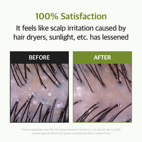RYO precision applicator tip focusing on targeted scalp delivery for neat application