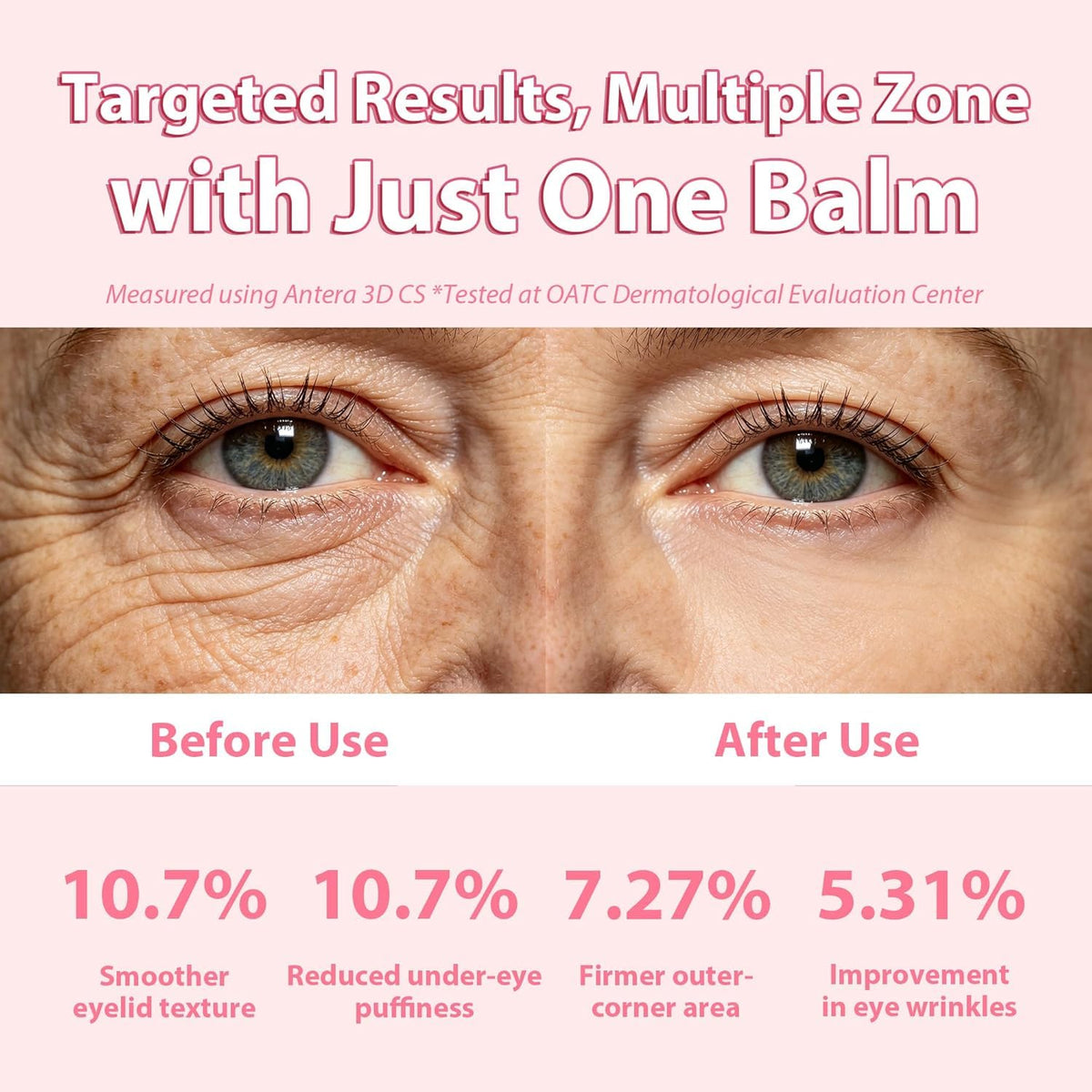 Saitir sak used on lips and smile lines showing targeted moisture and softer-looking lines