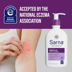 Sarna sensitive hand application image showing quick soothing relief on irritated skin