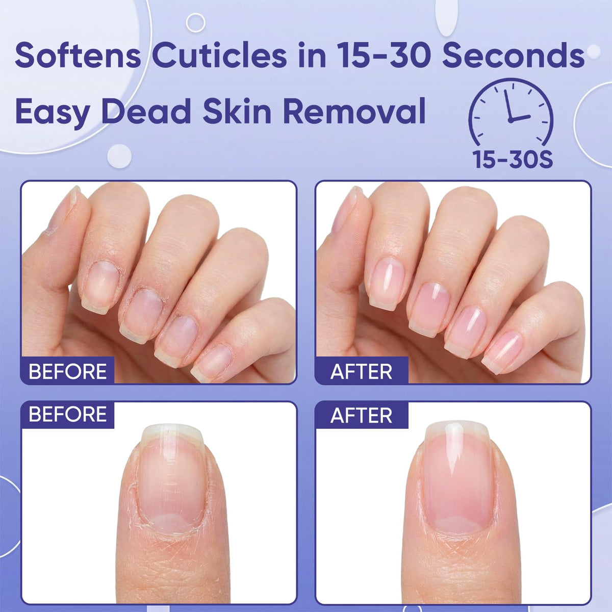 SASSYTIP before and after nails demonstrating visible cuticle improvement