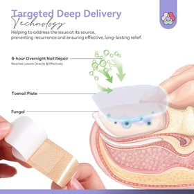 SAVILAND applying patch to toenail demonstrating easy overnight use