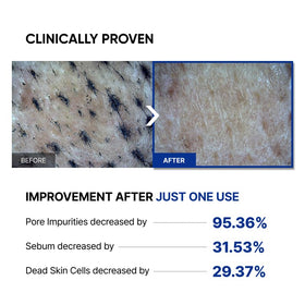 SAYNID before and after pores showing refined texture and smoother skin finish
