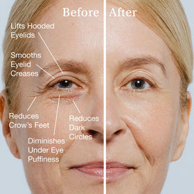 SBLA serum texture on skin demonstrating fast absorption benefit