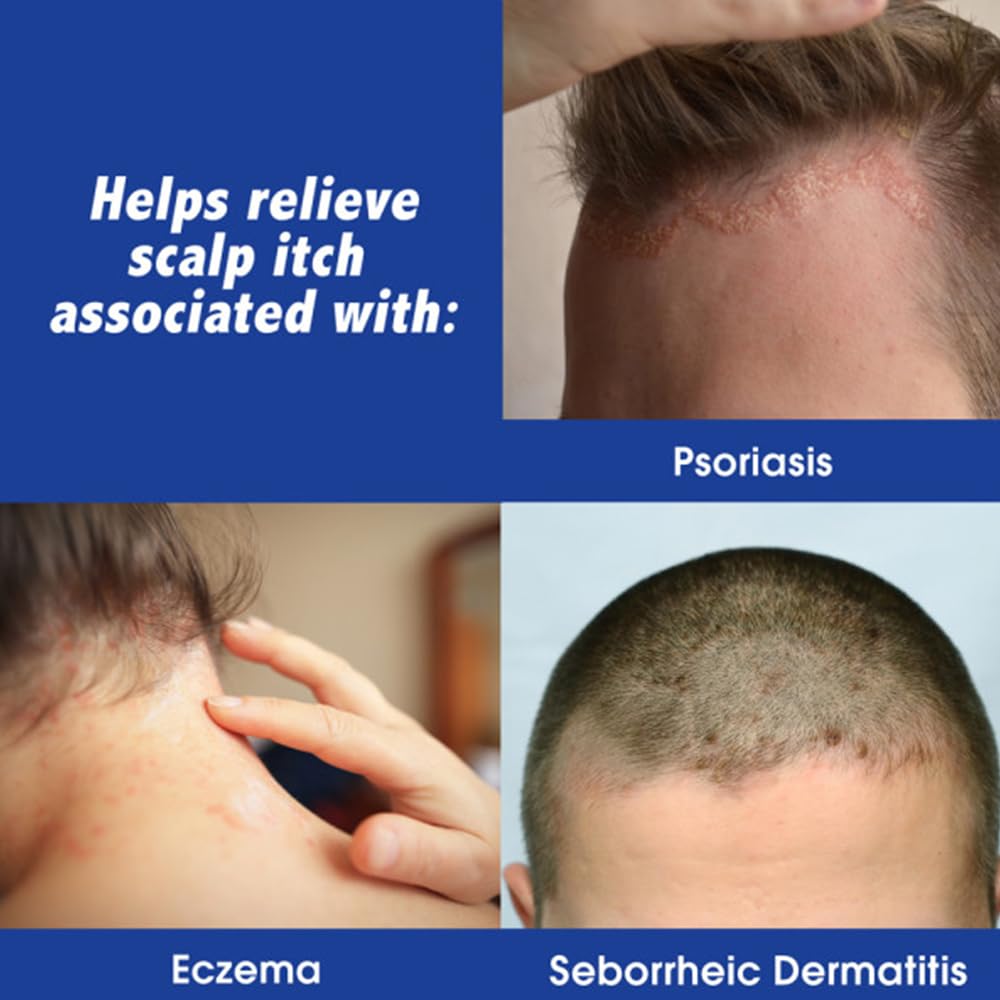 Close-up of Scalpicin liquid texture, greaseless formula absorbs without residue