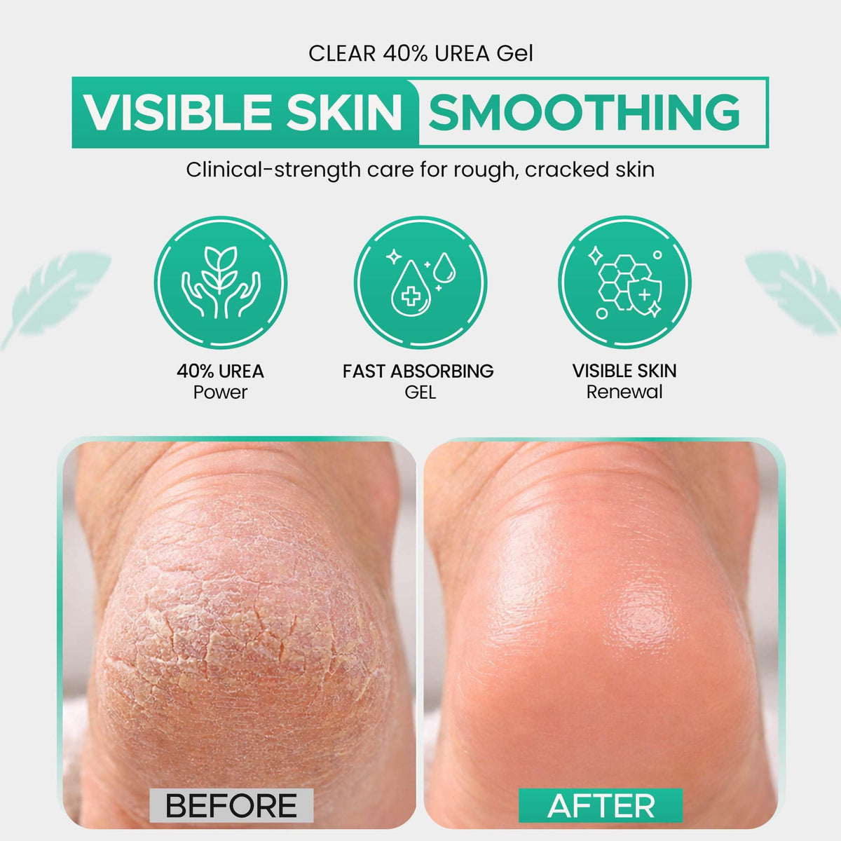 Scientific Solutions CLEAR 40 being applied to heel to show targeted relief and softening benefit