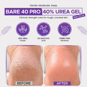 Scientific Solutions Global BARE 40 PRO open jar top view showing creamy gel for targeted use