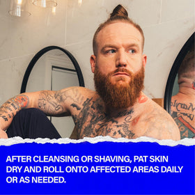 Scotch Porter applied to jawline after shave reducing bump appearance