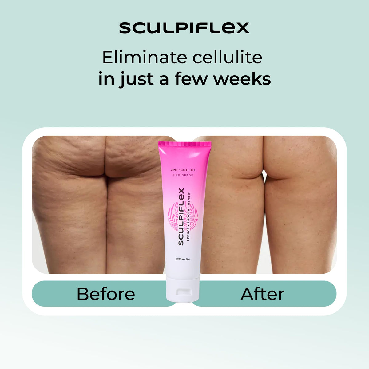 SCULPIFLEX cream used with Sculpiflex device to enhance absorption