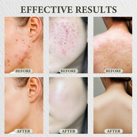 SDXJIOGE balm being applied to cheek showing soothing action and reduced redness