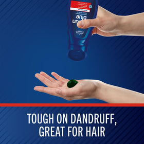 Close-up of menthol-infused foam from Selsun Blue showing cooling texture and soothing effect
