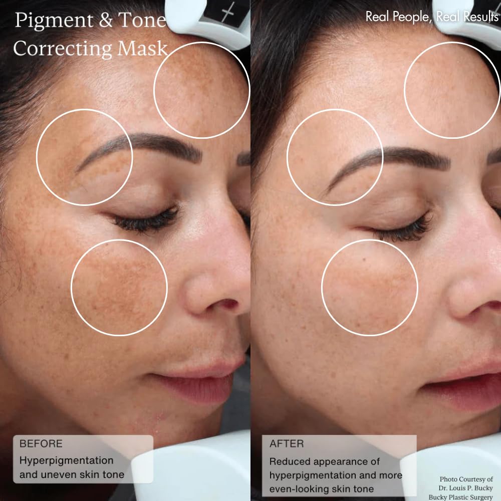 Sente applying product to cheek demonstrating controlled topical use