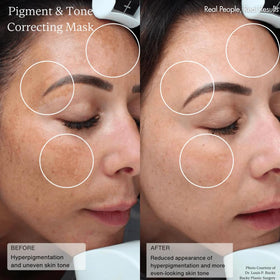 Sente applying product to cheek demonstrating controlled topical use