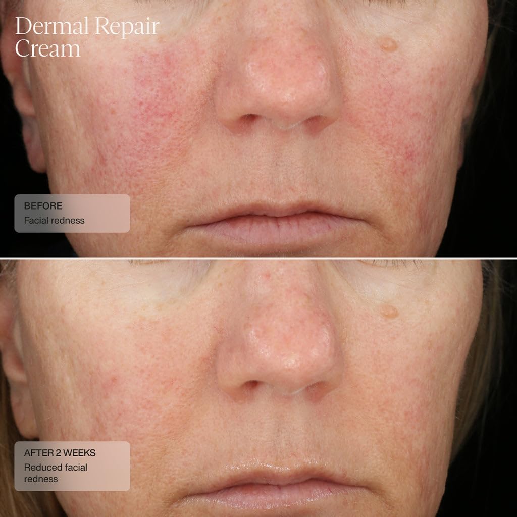 Sente Dermal Repair cream texture close-up showing smooth, non-greasy finish