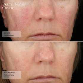 Sente Dermal Repair cream texture close-up showing smooth, non-greasy finish