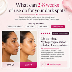 Seora skins applied to face illustrating even tone and smooth base
