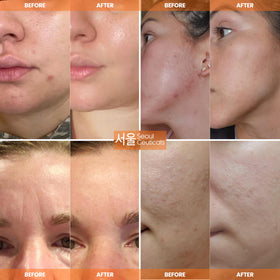 SeoulCeuticals cream on hand demonstrating spreadability and lightweight finish