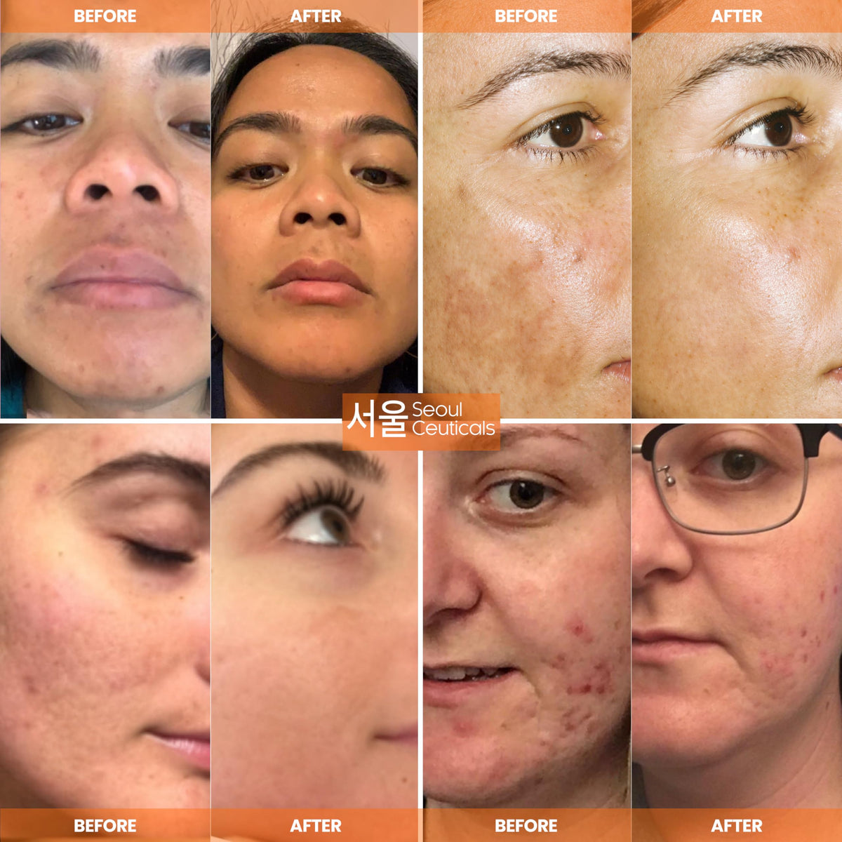 SeoulCeuticals serum texture pool showing lightweight hydration and smooth finish
