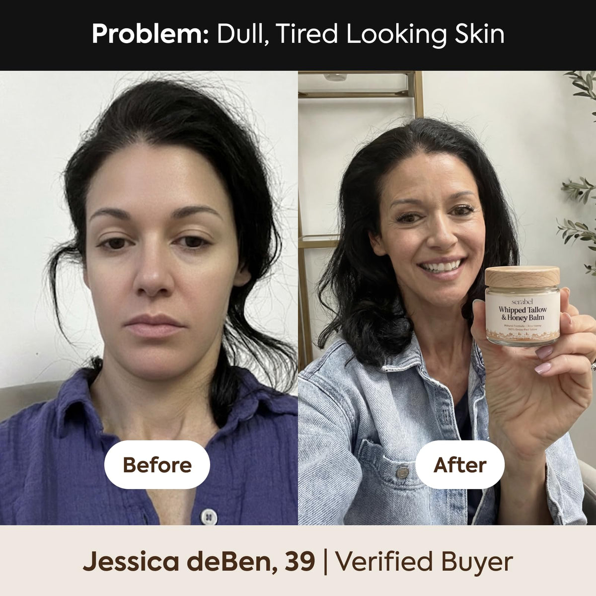 SERABEL balm used on lips and cuticles to illustrate targeted soothing and repair