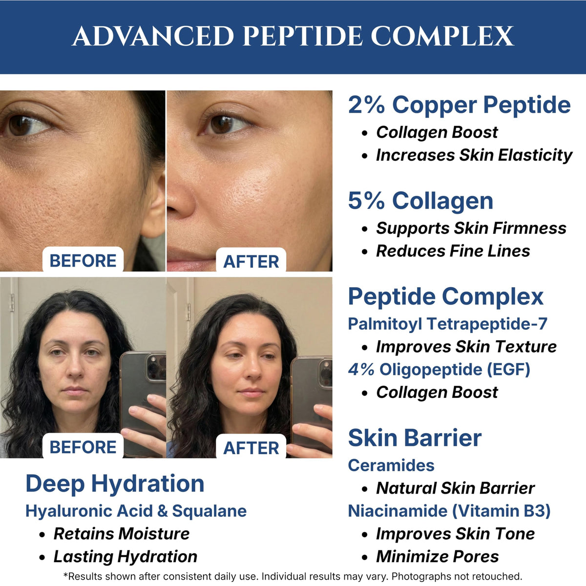 Seraphime label and ingredient list visible to show peptide and EGF content