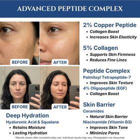 Seraphime label and ingredient list visible to show peptide and EGF content