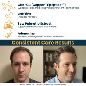 Applying Seraphime to scalp parting, illustrates targeted use for improved scalp care