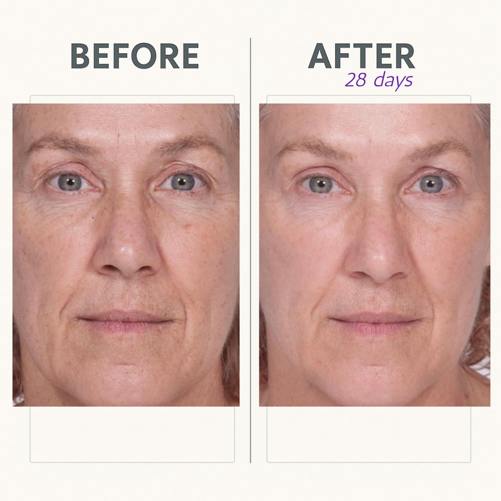 Serious Skincare application on face and neck for targeted lifting