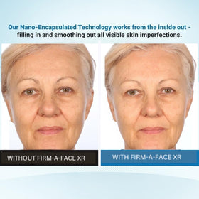 Serious Skincare before and after comparison showing reduced lines benefit