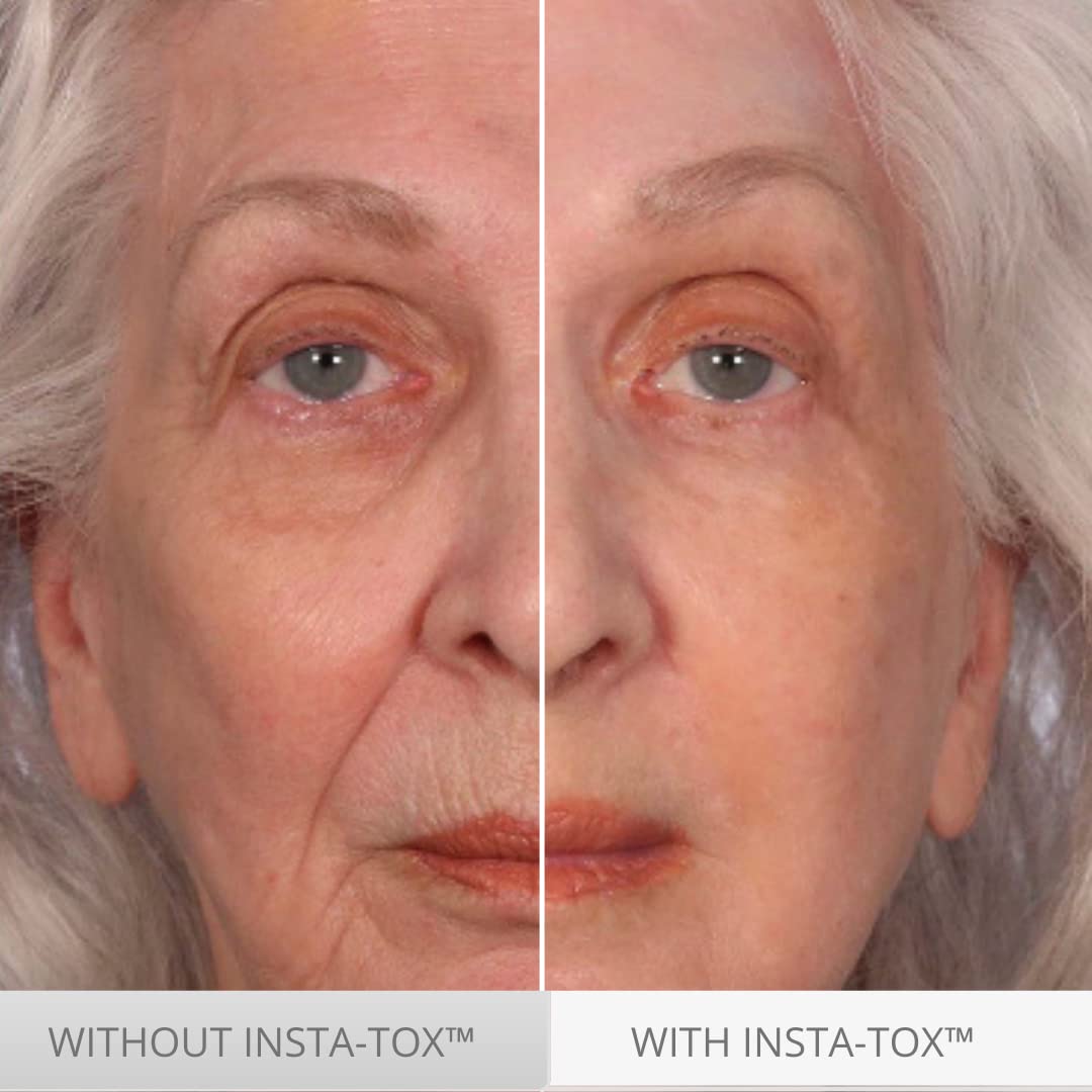 Serious Skincare applying serum near eye area to reduce appearance of crow’s feet