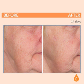 Serious Skincare open jar top-down view revealing creamy formula for overnight use