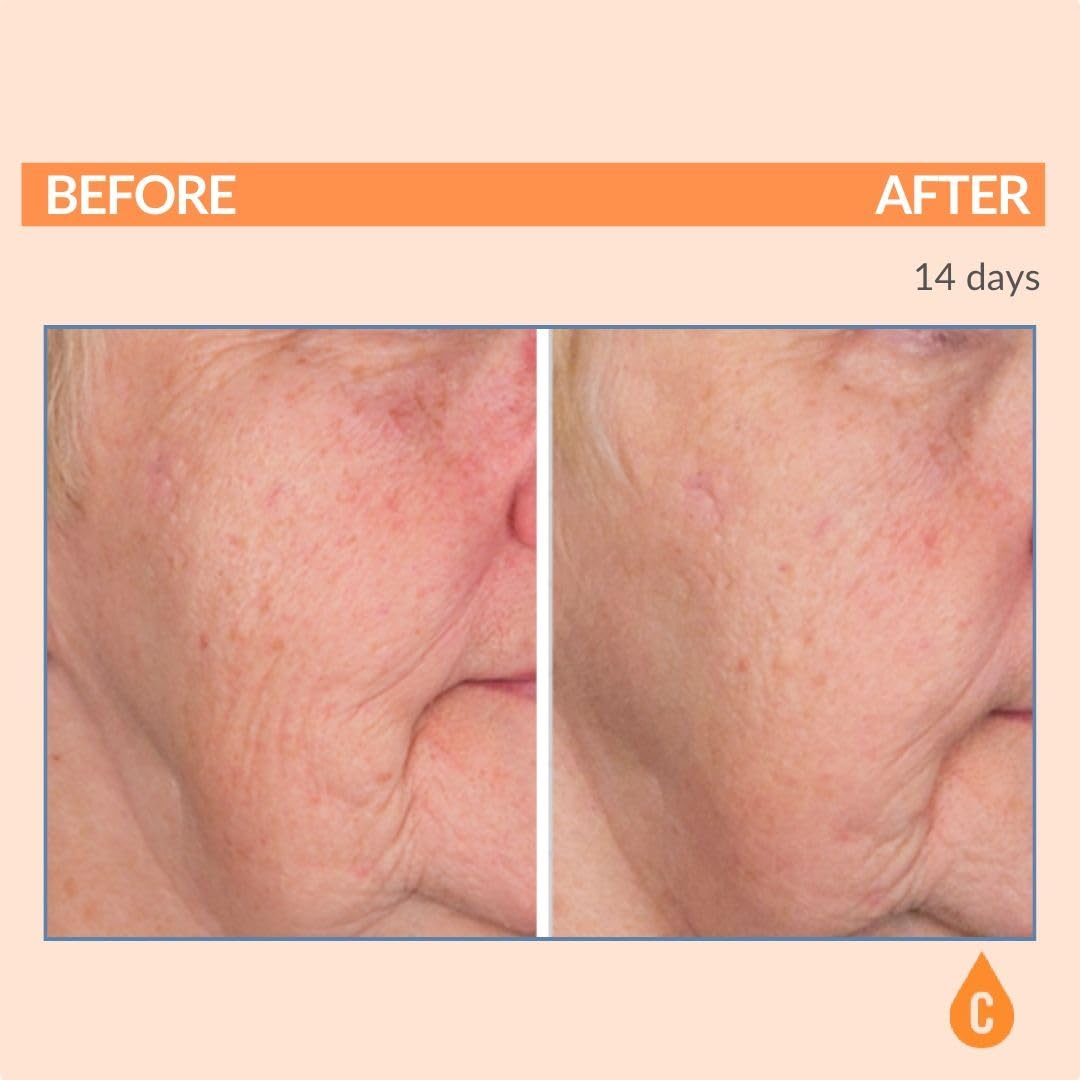 Serious Skincare pump dispenser view for convenient controlled use