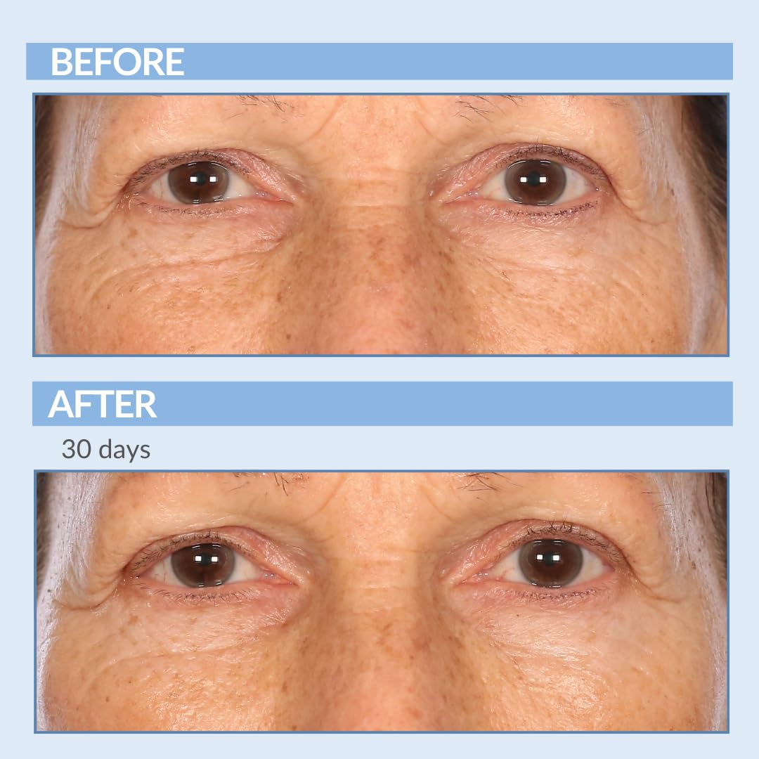 Serious Skincare retinol applied on hand demonstrating smooth spreadability and hydration