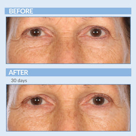 Serious Skincare retinol applied on hand demonstrating smooth spreadability and hydration