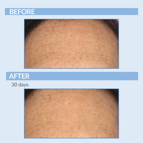 Serious Skincare retinol ingredients label emphasizing vitamin A and botanicals