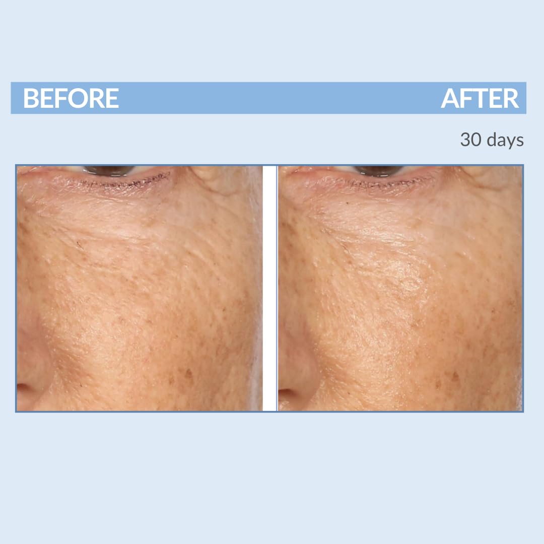 Serious Skincare retinol cream texture close-up showing creamy, fast-absorbing formula