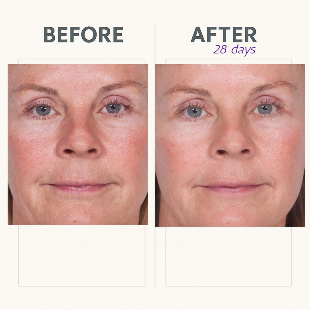 Serious Skincare 1 oz size comparison demonstrating travel-friendly convenience