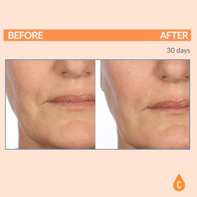 Serious Skincare next to ruler for accurate size and travel-friendly benefit