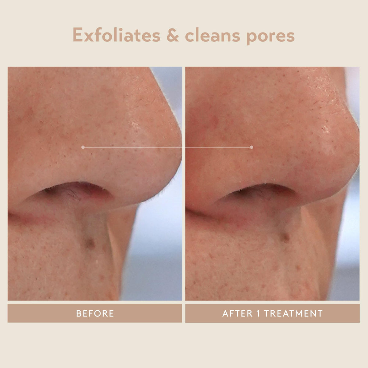 SHANI DARDEN neutralizing mask massaged into skin demonstrating calming step