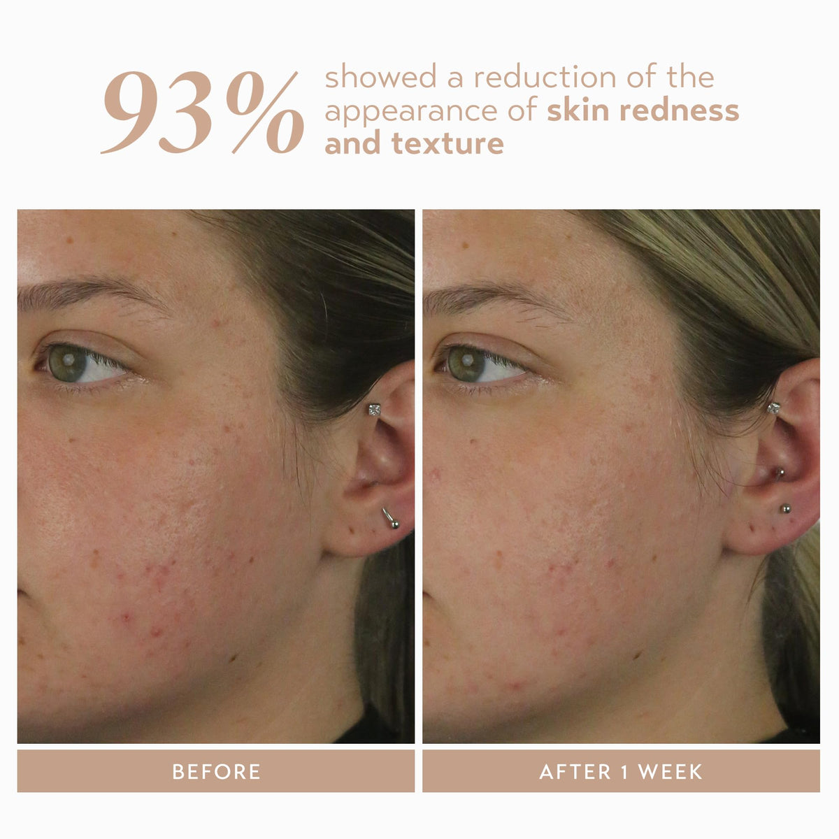 SHANI DARDEN application in evening routine for balanced skin