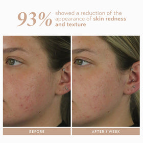 SHANI DARDEN application in evening routine for balanced skin