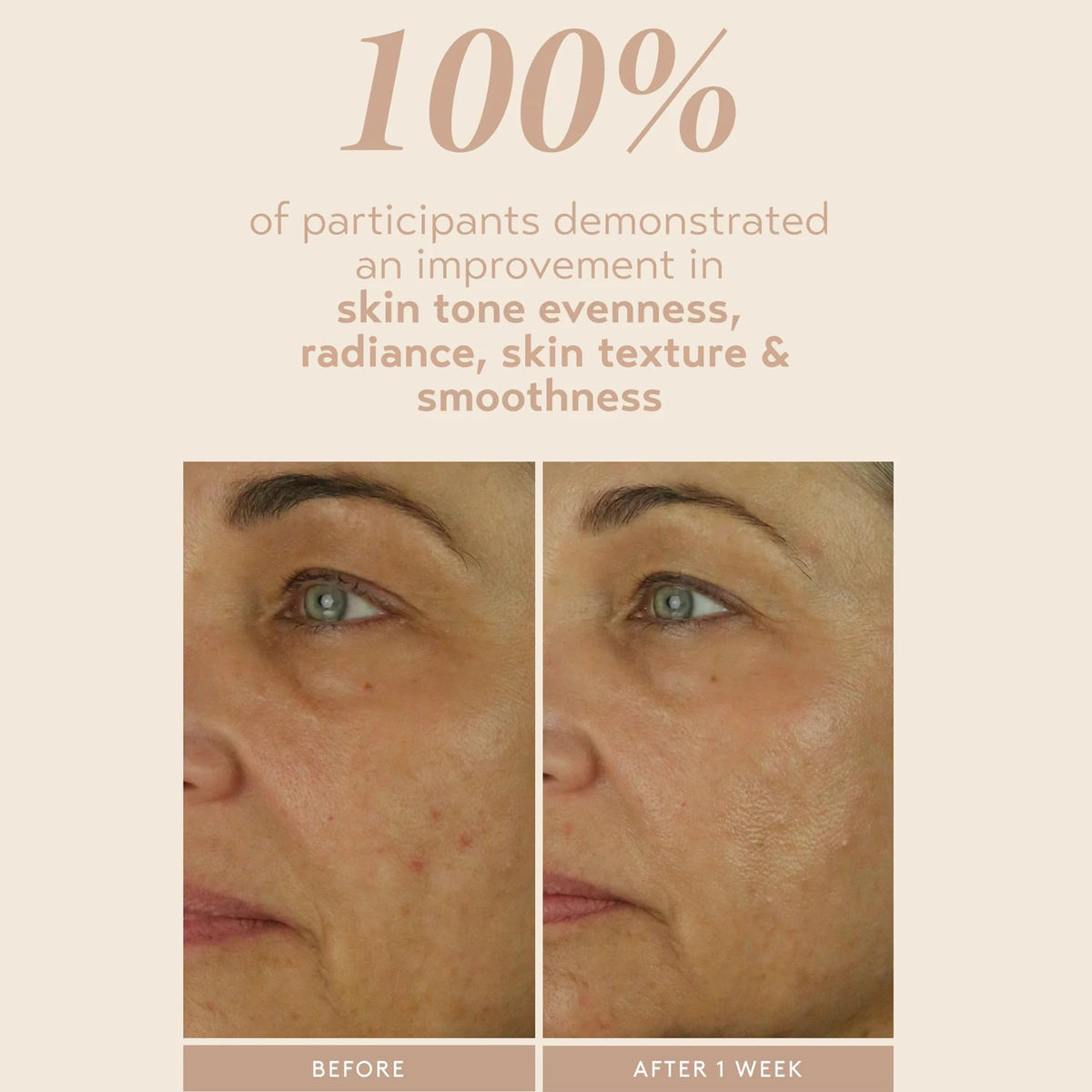 SHANI DARDEN applying serum to face and neck for targeted nightly renewal
