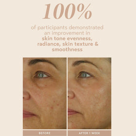 SHANI DARDEN serum being applied on hand to show smooth absorption and hydration
