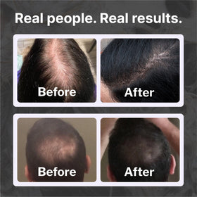 Shapiro MD foam texture closeup illustrating airy, non-greasy finish benefit