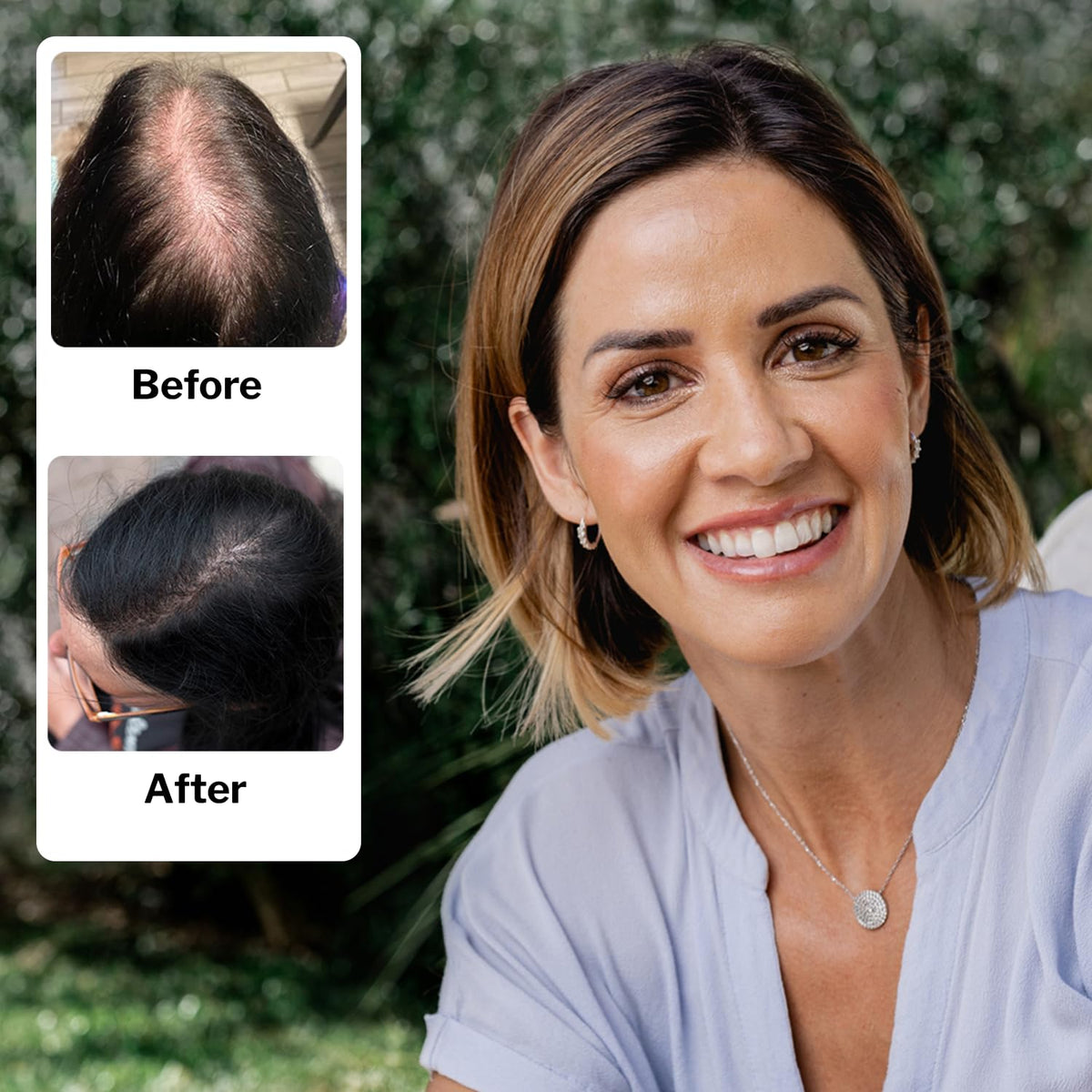 Shapiro MD shampoo texture and lather demonstrating gentle cleansing benefit