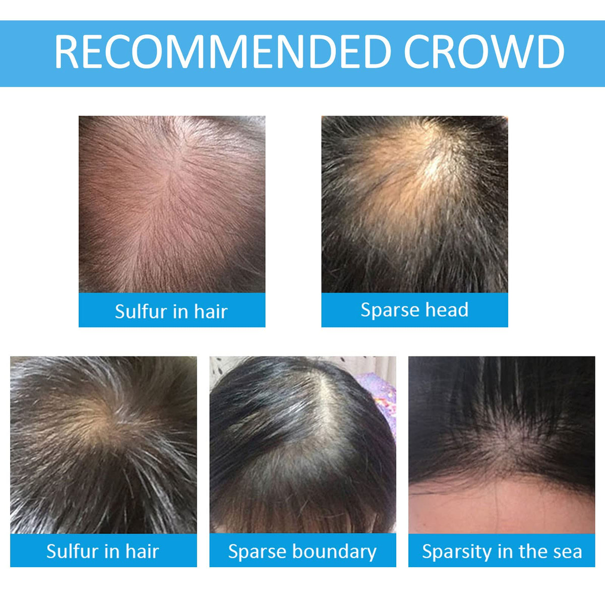 SHIFAKOU application on crown in use for instant visible densifying