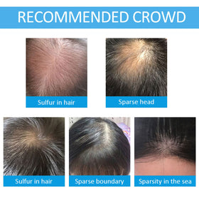 SHIFAKOU before and after side profile comparison illustrating visible hair thickening