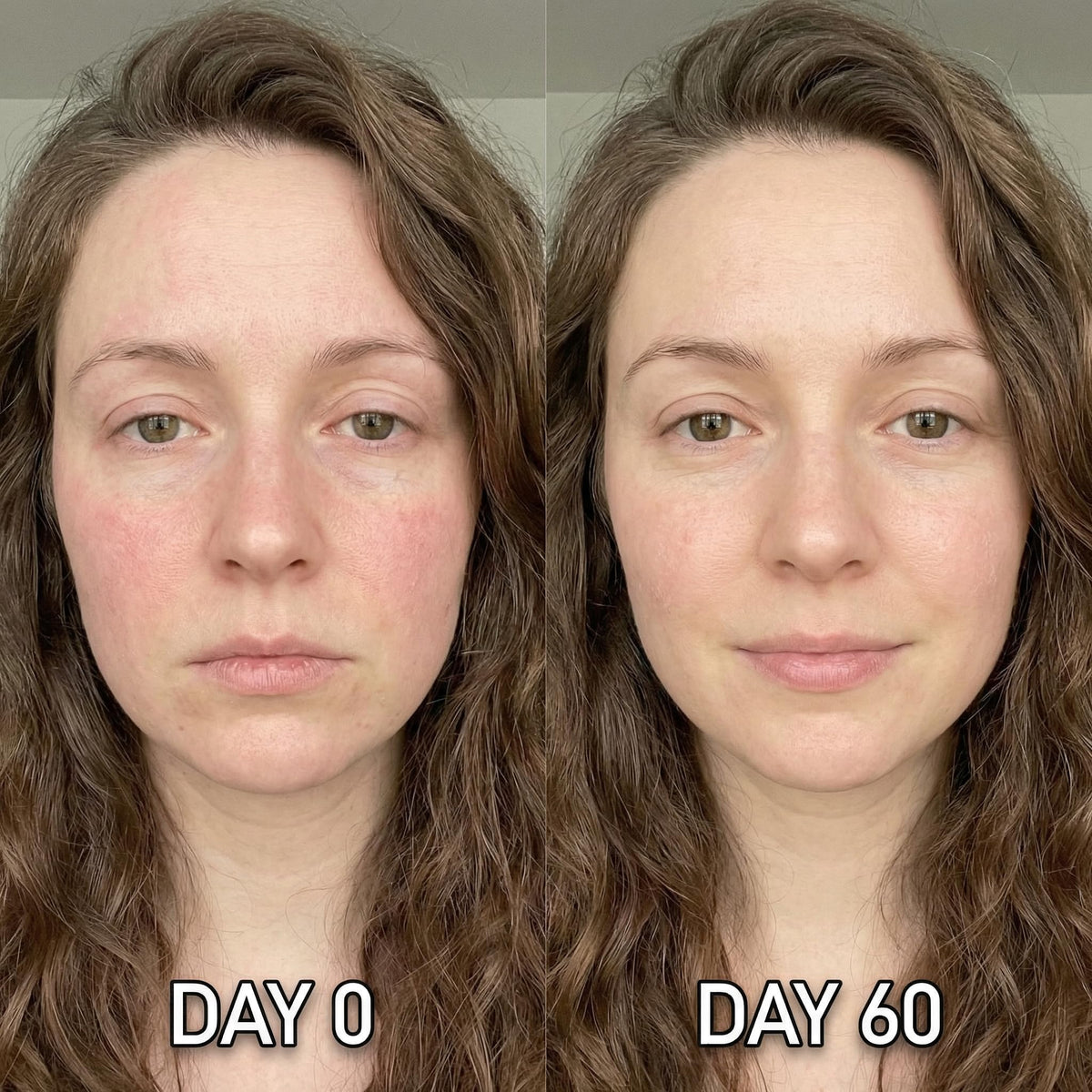 Shining Face demonstrated neck treatment showing targeted coverage