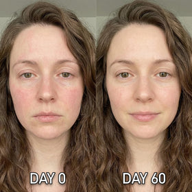 Shining Face demonstrated neck treatment showing targeted coverage